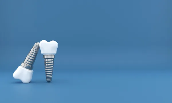 two-implants-dr-sebastian-fotescu-zahnarztpraxis-dresden-webp